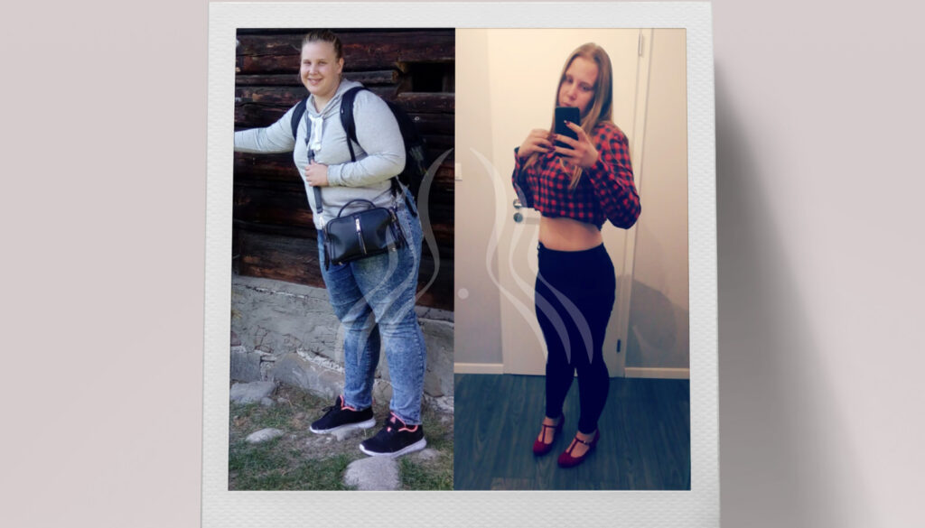 Ema Turčan: 35 kg manje za 7 mjeseci