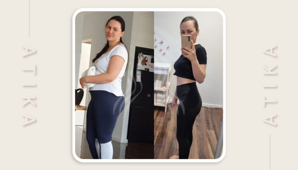 Zorica Kuzmanović – 13 kilograma manje uz sedmomjesečnu bebu