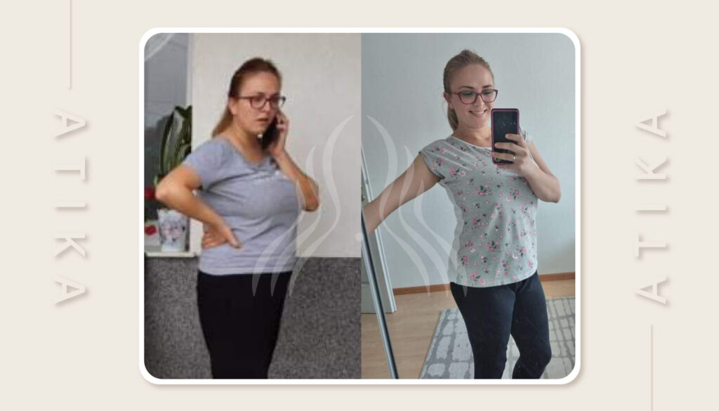 Saliha Bjelkić – Hašimoto nije prepreka za gubitak kilograma
