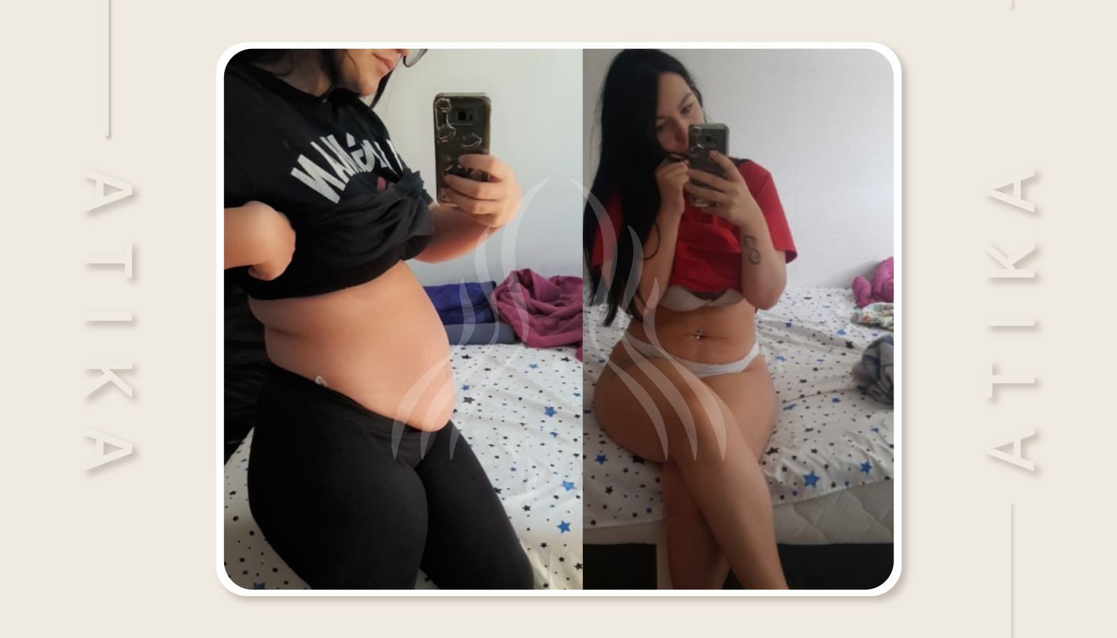 Dragana - Gubitak kilograma nakon dva poroda uz dojenje